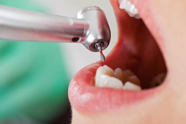 Best Emergency Cosmetic Dentistry in Harbor Springs, MI